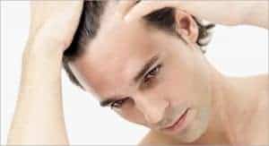 Green Pharmacy, user reviews of shampoo and potion for hair loss 2 a man checks if he has sideburns