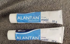Alantan - will it remove acne scars and blemishes? 3 alantan tubes