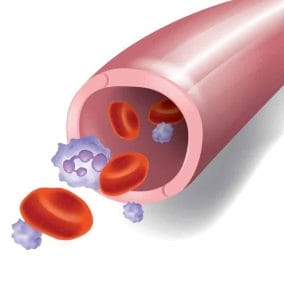 Varicose veins of lower limbs - what is it, how to prevent? Varicose veins diet 2 Vein diagram