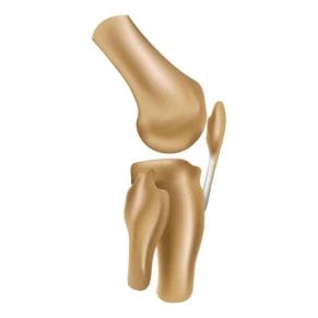 Collagen - causes and effects of deficiency. Collagen sources 3 bone and knee joint diagram