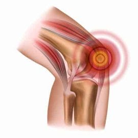  knee joint pain