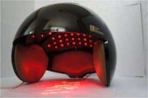 Laser therapy for hair loss opinions and effects it gives 2 laser