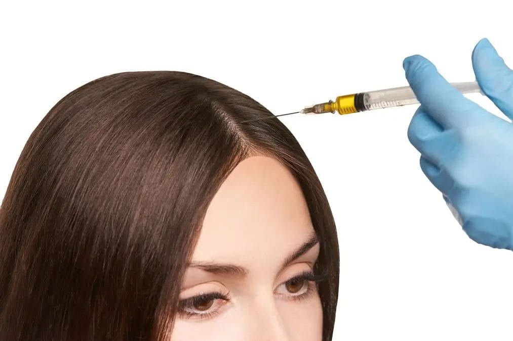 Mesotherapy of hair - opinions, effects and procedure course 1 mezoterapy
