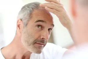 Carboxytherapy of the scalp - is it effective for baldness? 2 balding man