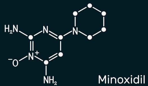 Minoksydyl or finasteride - pharmacological treatment of alopecia. 3 minoxidil chemical formula