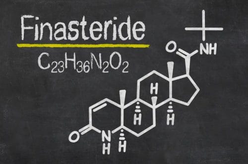 Minoksydyl or finasteride - pharmacological treatment of alopecia. 4 finasteride chemical formula