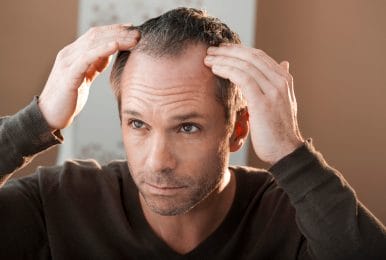 Horsetail - health and hair loss preventing properties 2 Male pattern baldness