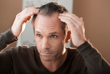  Male pattern baldness