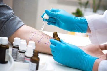 Allergy - its triggers, types and treatment methods 3 allergy tests