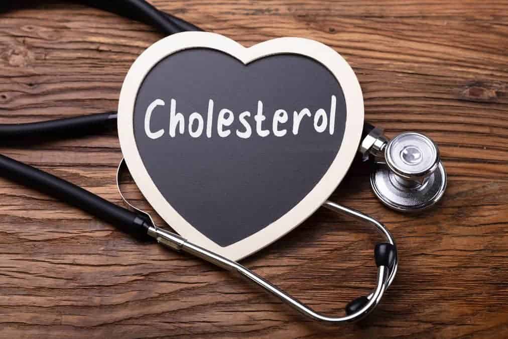 High serum cholesterol, causes and symptoms of elevated levels, natural methods to lower them 1 Depositphotos 212506468 XL